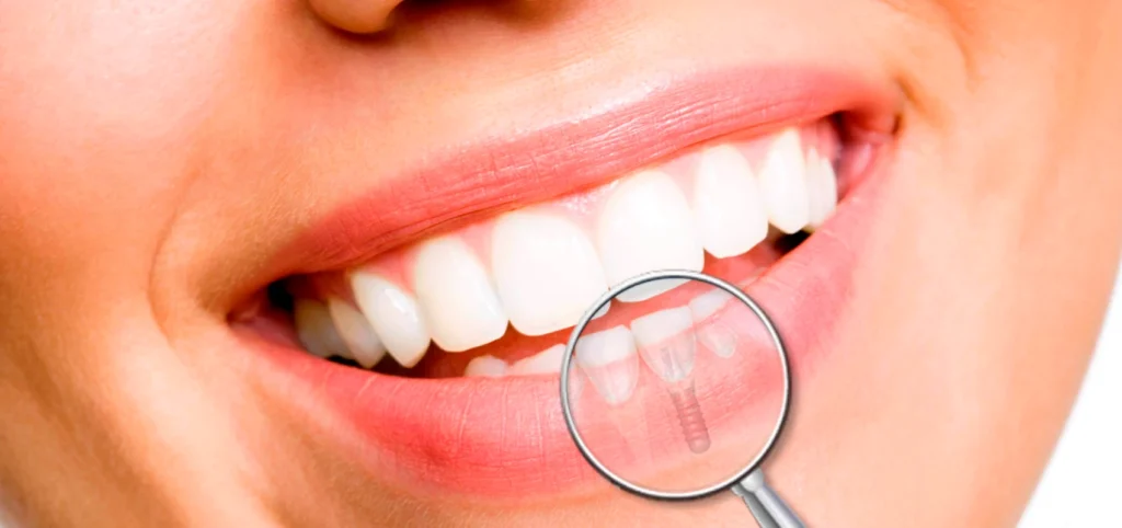 dentiste à Toulouse 31000